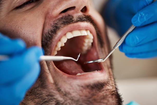 Best Tooth Pain Emergency Relief  in Buckeystown, MD